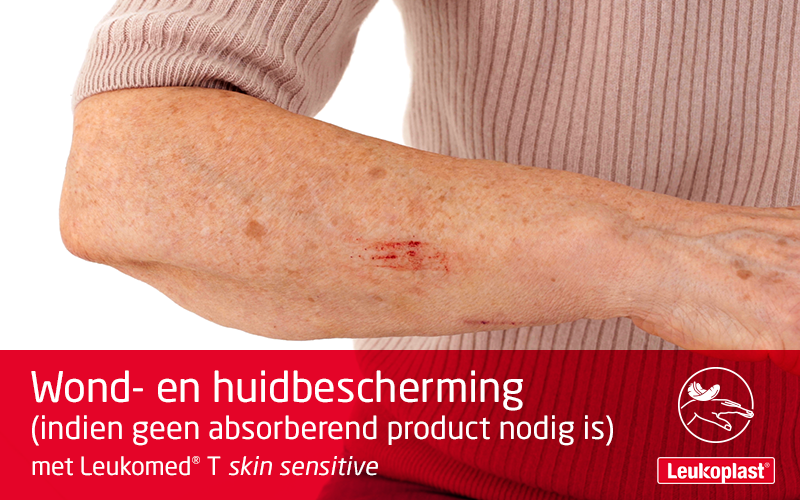Deze video laat zien hoe een transparante wondfolie wordt gebruikt op een kwetsbare huid: we zien de handen van een zorgprofessional die Leukomed T-skin sensitive aanbrengt op een schram op de onderarm van een oudere dame. Deze video laat zien hoe een transparante wondfolie wordt gebruikt op een kwetsbare huid: we zien de handen van een zorgprofessional die Leukomed T-skin sensitive aanbrengt op een schram op de onderarm van een oudere dame.